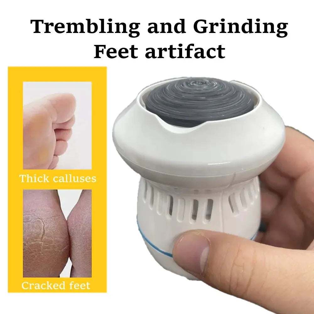 Vacuum Callus Remover - Granted solutions