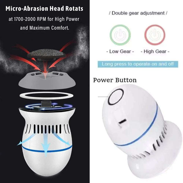 ProCallus Vacuum Remover